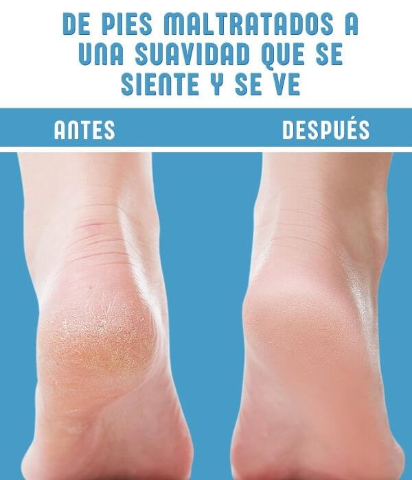 MEDIAS HIDRA-GEL, suaviza e hidrata tus Pies Secos y Agrietados